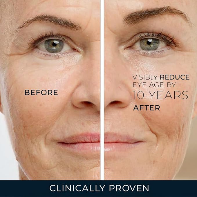 RoC Retinol Correxion Under Eye Cream for Dark Circles & Puffiness, Daily Wrinkle Cream, Anti Aging Skin Care Treatment Women and Men, 0.5 oz (Packaging May Vary)
