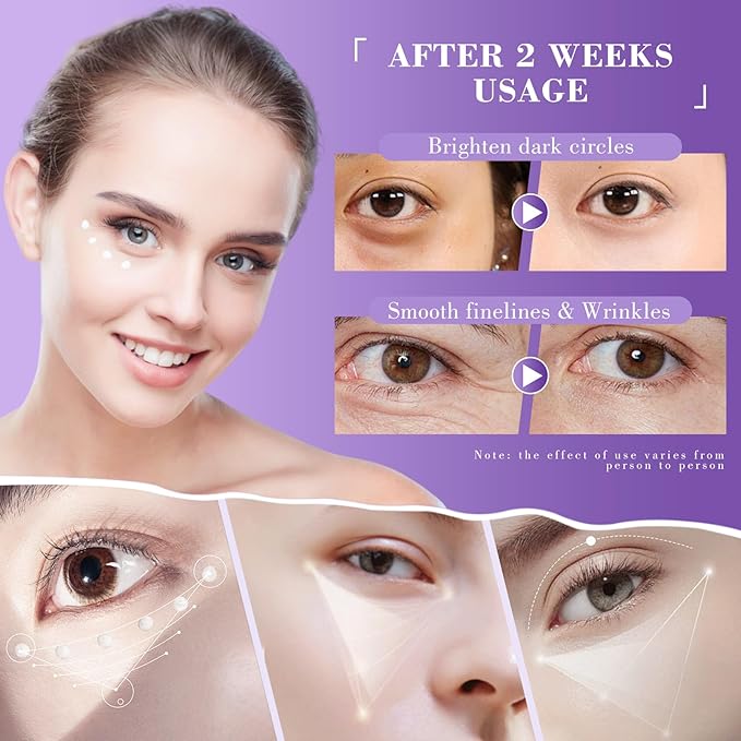 Eye Cream, Retinol Eye Cream for Dark Circles, Puffiness Anti Aging, With Hyaluronic Acid, Peptides, Caffeine Reduces Bags, Smooths Wrinkles & Fine Lines, Dark Circles Under Eye Treatment, 2Pack
