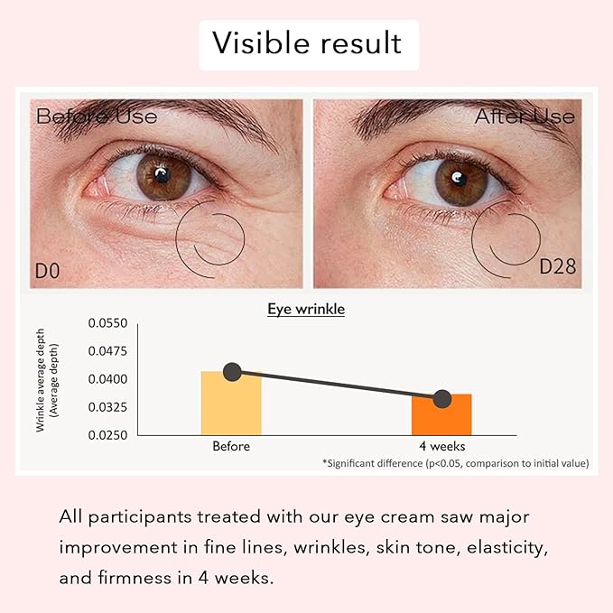 Revive Eye Serum, Eye Cream for Dark Circles, Wrinkles & Puffiness, Visibly Smoothes Fine Lines, Daily Use, 30ml, 1 fl.oz